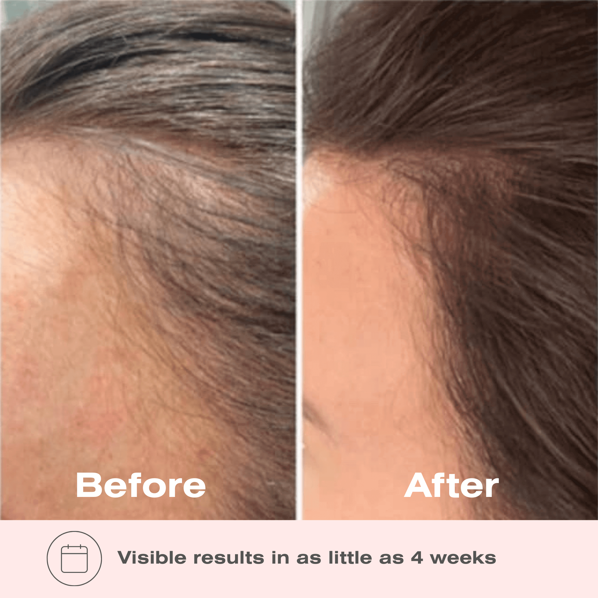 Boombiotics Hair Growth Supplement