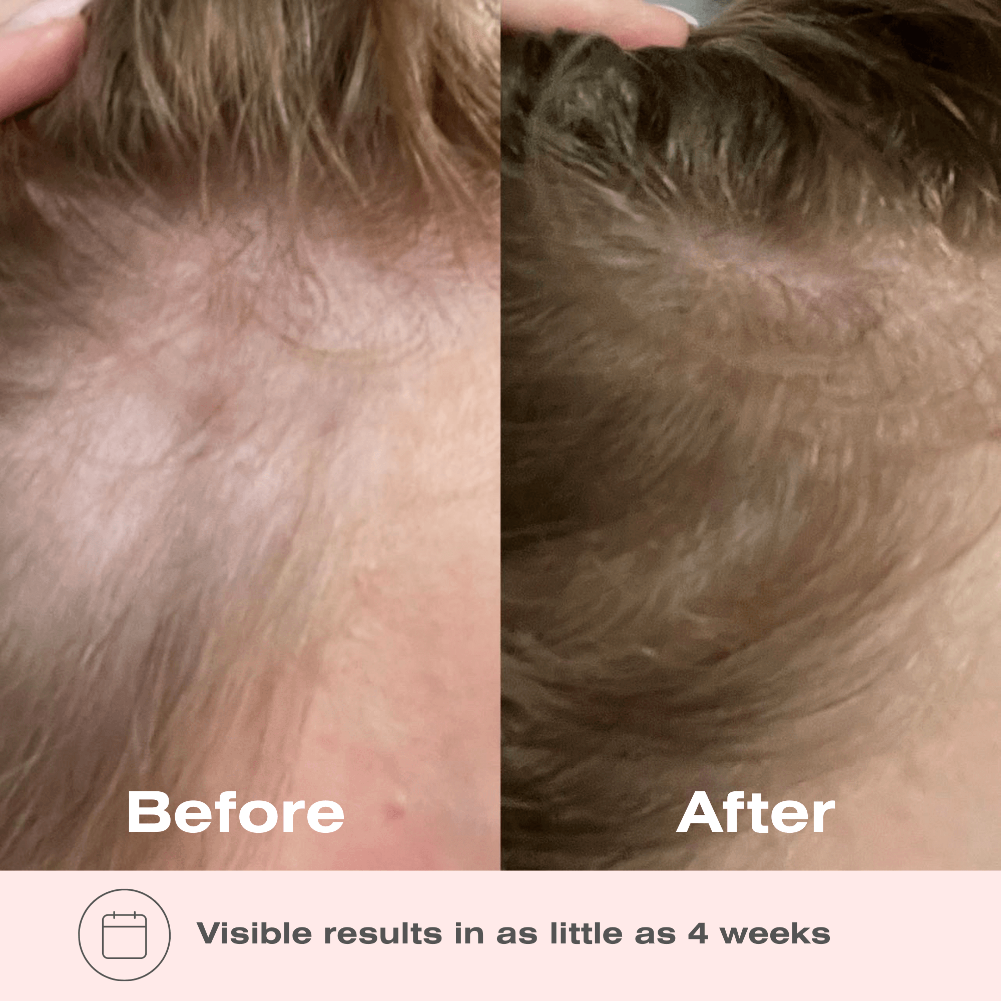 Boombiotics Hair Growth Supplement