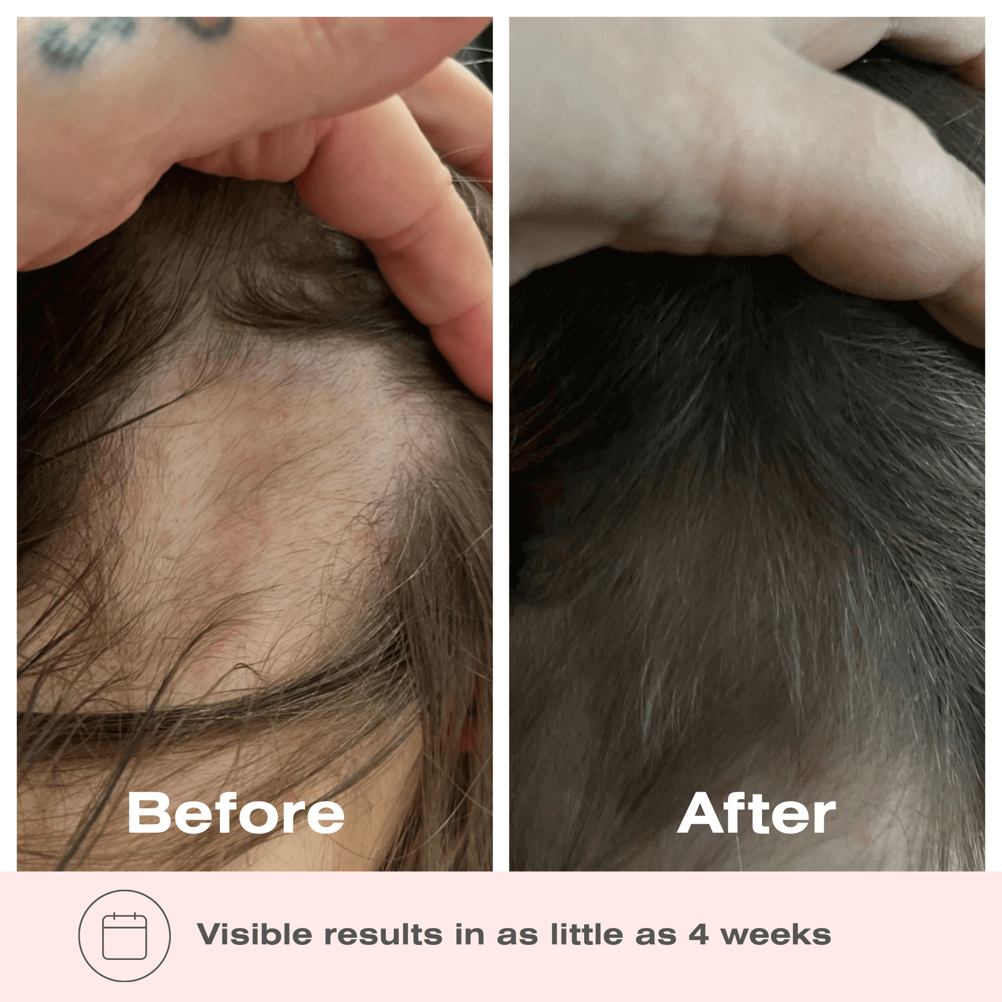 Boombiotics Hair Growth Supplement